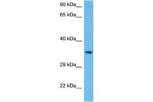 Host:  Mouse  Target Name:  PITX1  Sample Tissue:  Mouse Brain  Antibody Dilution:  1ug/ml (PITX1 antibody  (N-Term))