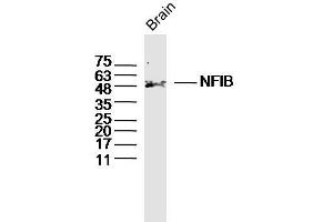 Mouse Brain lysates probed with NFIB Polyclonal Antibody, Unconjugated  at 1:300 dilution and 4˚C overnight incubation. (Nfib/Nf1b2 (AA 1-100) antibody)