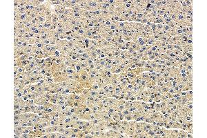 anti-X-Ray Radiation Resistance Associated 1 (XRRA1) antibody