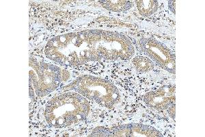 IHC analysis of HRAS using anti-HRAS antibody (ABIN3043845).