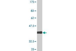 Western Blot detection against Immunogen (37.