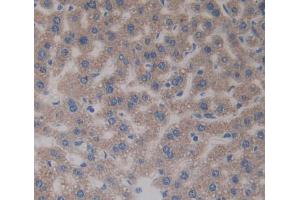 Figure. (TFPI2 antibody  (AA 23-230))