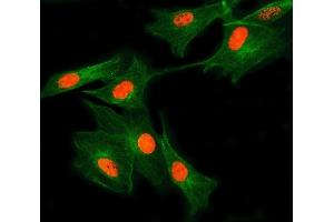 IF analysis of SNRNP27 and Tubulin beta using anti-SNRNP27 antibody (ABIN7599614) and anti-Tubulin beta antibody (ABIN7602744). (SNRNP27 antibody  (AA 100-155))