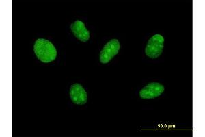 Immunofluorescence of purified MaxPab antibody to ZNF471 on Daoy cell. (ZNF471 antibody  (AA 1-626))