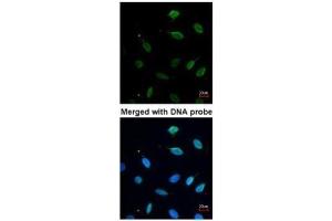ICC/IF Image Immunofluorescence analysis of paraformaldehyde-fixed HeLa, using MCM7, antibody at 1:200 dilution. (MCM7 antibody)