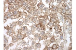 anti-Moloney Leukemia Virus 10 (MOV10) (AA 953-1003) antibody