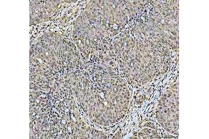 IHC analysis of DCK using anti-DCK antibody (ABIN5693016).
