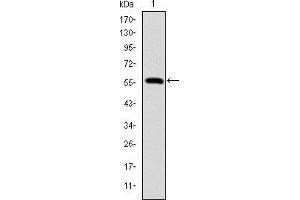 Western blot analysis using LMNA mAb against human LMNA (AA: 212-477) recombinant protein.