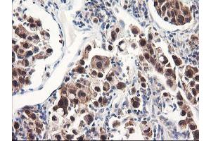 Image no. 8 for anti-F-Box Protein 21 (FBXO21) antibody (ABIN1498232) (FBXO21 antibody)