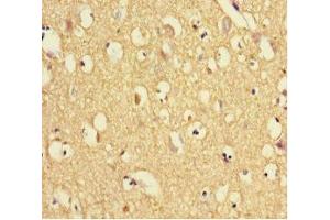 Immunohistochemistry of paraffin-embedded human brain tissue using ABIN7172010 at dilution of 1:100