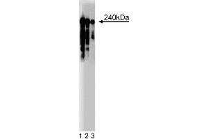 Western blot analysis of CRIK on Rat PC12 cell lysate (ATCC CRL-1721). (CIT antibody  (AA 1420-1612))