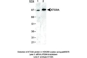Image no. 1 for anti-ATG9 Autophagy Related 9 Homolog A (S. Cerevisiae) (ATG9A) (AA 750-839), (C-Term) antibody (ABIN363584) (ATG9A antibody  (C-Term))