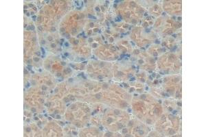 Used in DAB staining on fromalin fixed paraffin- embedded kidney tissue (PTPN21 antibody  (AA 983-1176))