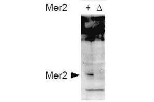 Western blot using  affinity purified anti-S.