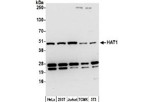 anti-Histone Acetyltransferase 1 (HAT1) (AA 369-419) antibody