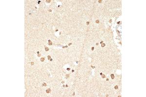 Immunohistochemistry (IHC) image for anti-Histone Cluster 1, H2ae (HIST1H2AE) antibody (ABIN7267703)