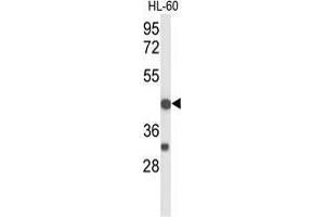 Western blot analysis of TNFRSF10D Antibody (Center) in HL-60 cell line lysates (35 µg/lane).
