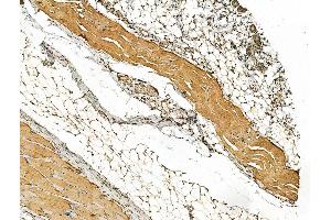 ABIN6262768 and ABIN6266577 at 1/100 staining Rat skin tissue by IHC-P.