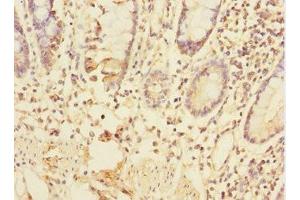 Immunohistochemistry of paraffin-embedded human small intestine tissue using ABIN7172318 at dilution of 1:100 (TRIAP1 antibody  (AA 1-76))