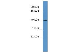 WB Suggested Anti-RASSF6 Antibody Titration: 0. (RASSF6 antibody  (Middle Region))