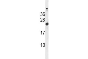 Hras1 antibody western blot analysis in mouse bladder tissue lysate. (HRAS antibody  (AA 151-179))