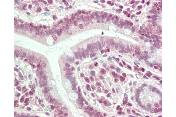 HS6ST3 antibody  (C-Term)