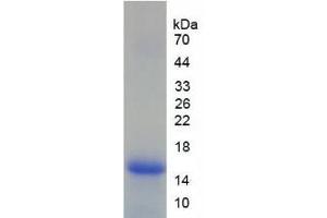 SDS-PAGE analysis of Human Lymphocyte Antigen 96 Protein.