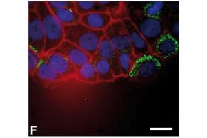 Immunofluorescence image of Thymosin beta10 staining of MCF7 cells in a wound/scratch assay. (Thymosin beta 10 antibody  (AA 1-14))