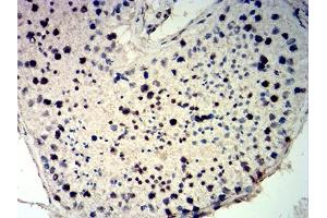 Immunohistochemical analysis of paraffin-embedded testis tissues using CDKN1C mouse mAb with DAB staining. (CDKN1C antibody)