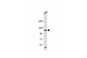 Western Blotting (WB) image for anti-Phosphoinositide-3-Kinase, Catalytic, delta Polypeptide (PIK3CD) (AA 687-717), (C-Term) antibody (ABIN392563)