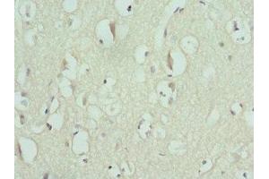 Immunohistochemistry of paraffin-embedded human brain tissue using ABIN7151371 at dilution of 1:100 (ENTPD2 antibody  (AA 28-268))