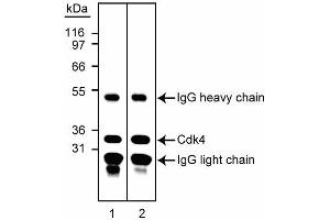Immunoprecipitiation/western blot analysis of Cdk4. (CDK4 antibody)