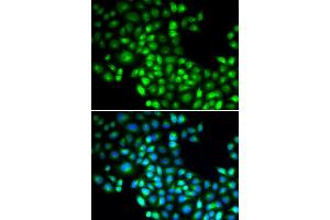 Immunofluorescence analysis of U20S cell using FOXP1 antibody. (FOXP1 antibody)