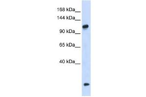 HEATR4 antibody used at 1 ug/ml to detect target protein. (HEATR4 antibody  (N-Term))
