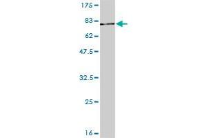 STAT3 monoclonal antibody (M01), clone 1D11-2A11. (STAT3 antibody  (AA 1-769))