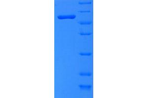 SDS-PAGE (SDS) image for Tryptophan 2,3-Dioxygenase (TDO2) (AA 1-406), (full length) protein (His-SUMO Tag) (ABIN5710470)