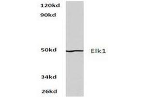 Image no. 1 for anti-ELK1, Member of ETS Oncogene Family (ELK1) antibody (ABIN265398) (ELK1 antibody)