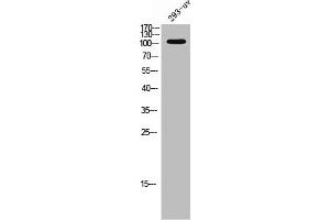 Western Blot analysis of 293T-UV cells using EphA3 Polyclonal Antibody (EPH Receptor A3 antibody  (C-Term))