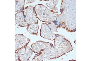 Immunohistochemistry of paraffin-embedded human placenta using PDGFRB antibody (ABIN3023138, ABIN3023139, ABIN3023140 and ABIN6219408) at dilution of 1:100 (40x lens). (PDGFRB antibody  (AA 887-1106))