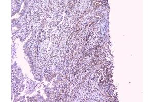 IHC analysis of PBP using anti-PBP antibody (ABIN5693043).