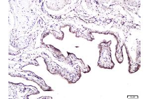 Paraformaldehyde-fixed, paraffin embedded rat bladder, Antigen retrieval by boiling in sodium citrate buffer (pH6) for 15min, Block endogenous peroxidase by 3% hydrogen peroxide for 30 minutes, Blocking buffer (normal goat serum) at 37°C for 20min, Antibody incubation with Syndecan 1 Polyclonal Antibody, Unconjugated  at 1:400 overnight at 4°C, followed by a conjugated secondary and for 20 minutes and DAB staining. (Syndecan 1 antibody  (AA 201-310))