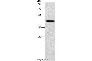 Western blot analysis of Mouse brain tissue, using B3GAT1 Polyclonal Antibody at dilution of 1:400 (CD57 antibody)