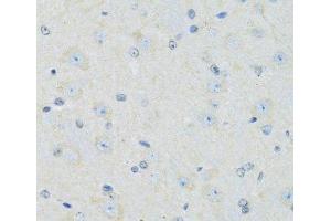 Immunohistochemistry of paraffin-embedded Mouse brain using SLC22A5 Polyclonal Antibody at dilution of 1:100 (40x lens). (SLC22A5 antibody)