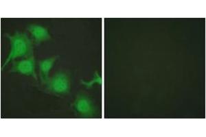 Immunofluorescence analysis of HuvEc cells, using Nrf2 Antibody. (NRF2 antibody  (AA 556-605))