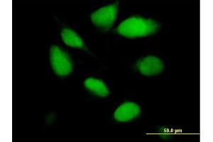 Immunofluorescence of purified MaxPab antibody to UNG on HeLa cell. (UNG antibody  (AA 1-304))