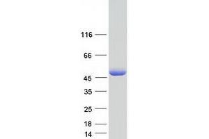 Homer Homolog 3 (Drosophila) (HOMER3) (Transcript Variant 1) protein (Myc-DYKDDDDK Tag)