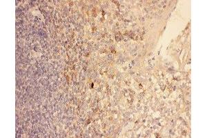 IHC-P: CXCR3 antibody testing of human tonsil tissue (CXCR3 antibody  (AA 1-368))