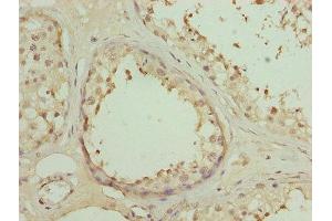 Immunohistochemistry of paraffin-embedded human testis tissue using ABIN7150657 at dilution of 1:100 (DSCR9 antibody  (AA 1-149))