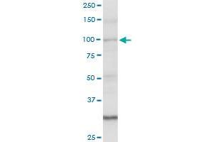 AMOTL1 MaxPab rabbit polyclonal antibody. (AMOTL1 antibody  (AA 1-956))