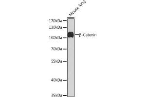 Western blot analysis of extracts of Mouse lung, using β-Catenin antibody (ABIN1684202, ABIN1512789, ABIN3020926 and ABIN3020928) at 1:1000 dilution.